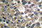 Matrix Metallopeptidase 19 antibody, LS-C176126, Lifespan Biosciences, Immunohistochemistry frozen image 