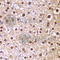 Cyclin D1 antibody, A1301, ABclonal Technology, Immunohistochemistry paraffin image 