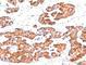 Keratin 5 antibody, V7099-100UG, NSJ Bioreagents, Western Blot image 