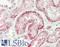 Plakophilin 4 antibody, LS-B13782, Lifespan Biosciences, Immunohistochemistry paraffin image 