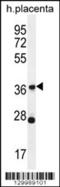 Olfactory Receptor Family 4 Subfamily L Member 1 antibody, 56-237, ProSci, Western Blot image 