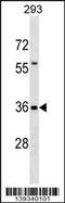 Protein TFG antibody, 60-355, ProSci, Western Blot image 