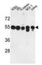 Protein Phosphatase, Mg2+/Mn2+ Dependent 1H antibody, AP53413PU-N, Origene, Western Blot image 