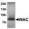 WW Domain Containing Adaptor With Coiled-Coil antibody, LS-C201071, Lifespan Biosciences, Western Blot image 