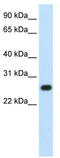 Ribosomal Oxygenase 2 antibody, TA345454, Origene, Western Blot image 