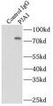 Praja Ring Finger Ubiquitin Ligase 1 antibody, FNab06477, FineTest, Immunoprecipitation image 