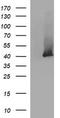 Serpin Family B Member 3 antibody, LS-C797771, Lifespan Biosciences, Western Blot image 