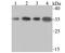 Small Nuclear Ribonucleoprotein Polypeptide A antibody, A08780-1, Boster Biological Technology, Western Blot image 