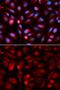 Acid Phosphatase 5, Tartrate Resistant antibody, GTX30018, GeneTex, Immunofluorescence image 