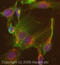 Desmoplakin antibody, ab71690, Abcam, Immunofluorescence image 