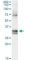 Nitrilase homolog 1 antibody, H00004817-M01, Novus Biologicals, Immunoprecipitation image 