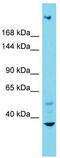 Integrator Complex Subunit 1 antibody, TA332219, Origene, Western Blot image 