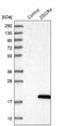 Down syndrome critical region protein 4 antibody, NBP1-84295, Novus Biologicals, Western Blot image 