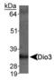 Iodothyronine Deiodinase 3 antibody, PA5-22886, Invitrogen Antibodies, Western Blot image 