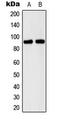 Cadherin 15 antibody, LS-C353928, Lifespan Biosciences, Western Blot image 
