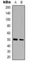 Zinc Finger Protein 436 antibody, orb318956, Biorbyt, Western Blot image 