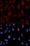 Phospholipase C Beta 1 antibody, 18-420, ProSci, Immunofluorescence image 