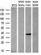 Baculoviral IAP Repeat Containing 7 antibody, GTX84823, GeneTex, Western Blot image 