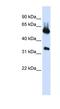 5'-Aminolevulinate Synthase 2 antibody, NBP1-54726, Novus Biologicals, Western Blot image 