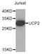 Uncoupling Protein 2 antibody, STJ26031, St John