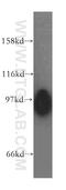 ATPase Sarcoplasmic/Endoplasmic Reticulum Ca2+ Transporting 3 antibody, 13619-1-AP, Proteintech Group, Western Blot image 