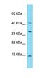 NADH:Ubiquinone Oxidoreductase Complex Assembly Factor 8 antibody, orb326895, Biorbyt, Western Blot image 