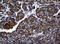 RAS Guanyl Releasing Protein 3 antibody, LS-C175627, Lifespan Biosciences, Immunohistochemistry paraffin image 