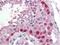 Cullin 4A antibody, NBP1-78040, Novus Biologicals, Immunohistochemistry paraffin image 
