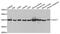 Sterol O-Acyltransferase 1 antibody, abx004078, Abbexa, Western Blot image 