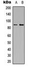 Histone H2B type 1 antibody, orb256581, Biorbyt, Western Blot image 