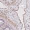 Ring Finger Protein 103 antibody, NBP2-31700, Novus Biologicals, Immunohistochemistry frozen image 