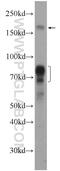 Nuclear Receptor Binding SET Domain Protein 3 antibody, 11345-1-AP, Proteintech Group, Western Blot image 