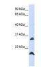 Spermatogenesis Associated 9 antibody, NBP1-59460, Novus Biologicals, Western Blot image 