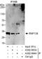 E3 ubiquitin-protein ligase RNF138 antibody, A302-993A, Bethyl Labs, Immunoprecipitation image 