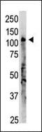 2'-5'-Oligoadenylate Synthetase 3 antibody, PA5-13211, Invitrogen Antibodies, Western Blot image 