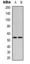 p53 antibody, orb339086, Biorbyt, Western Blot image 