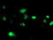 PHD Finger Protein 21B antibody, TA503205, Origene, Immunofluorescence image 