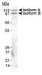Erythrocyte Membrane Protein Band 4.1 Like 3 antibody, PA1-46313, Invitrogen Antibodies, Western Blot image 