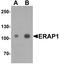 Endoplasmic Reticulum Aminopeptidase 1 antibody, LS-C201125, Lifespan Biosciences, Western Blot image 