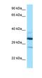 Deoxyhypusine hydroxylase antibody, orb326373, Biorbyt, Western Blot image 
