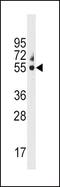 Cytochrome P450 Family 3 Subfamily A Member 5 antibody, PA5-14903, Invitrogen Antibodies, Western Blot image 