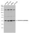 Glutamate-Ammonia Ligase antibody, PA5-28940, Invitrogen Antibodies, Western Blot image 