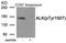 ALK Receptor Tyrosine Kinase antibody, AP55917PU-N, Origene, Western Blot image 