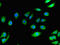 C-C Motif Chemokine Receptor 3 antibody, CSB-PA004842LA01HU, Cusabio, Immunofluorescence image 