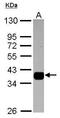 Aldo-Keto Reductase Family 1 Member B10 antibody, GTX116651, GeneTex, Western Blot image 