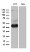 Pleckstrin homology-like domain family A member 1 antibody, LS-C795674, Lifespan Biosciences, Western Blot image 