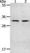 NME/NM23 Nucleoside Diphosphate Kinase 6 antibody, PA5-50245, Invitrogen Antibodies, Western Blot image 