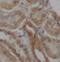 CDH2 antibody, FNab10068, FineTest, Immunohistochemistry paraffin image 
