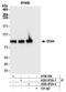 Hyaluronate receptor antibody, A303-872A, Bethyl Labs, Immunoprecipitation image 
