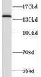 SAFB Like Transcription Modulator antibody, FNab07989, FineTest, Western Blot image 